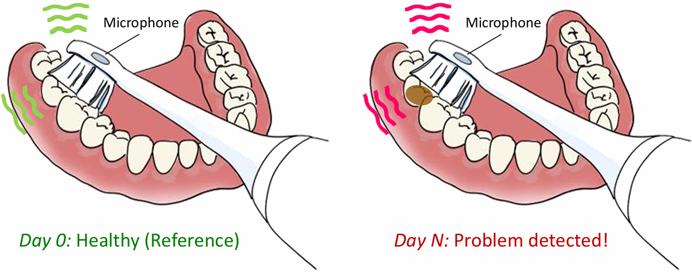 Illustrated image of brushing teeth