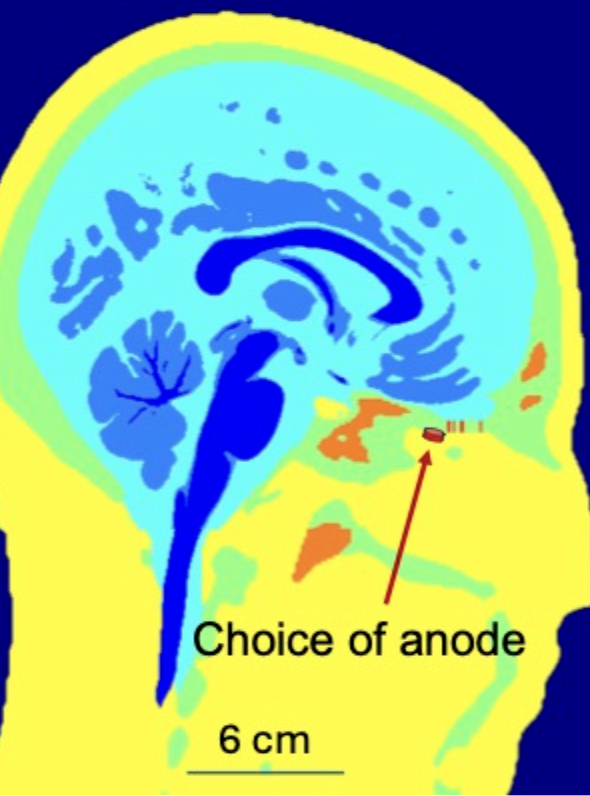 brain