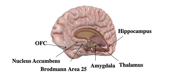 brain
